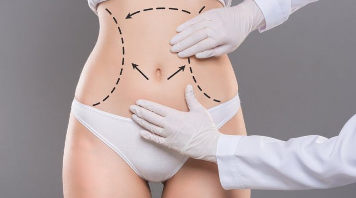 تكلفة شفط الدهون بالفيزر