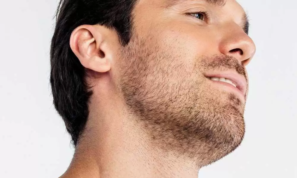 شروط زراعة الشعر