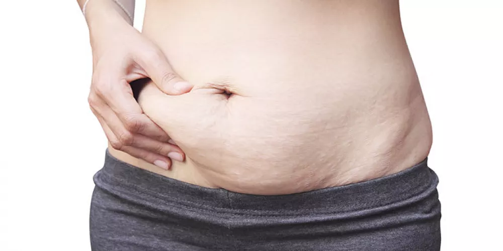 مخاطر ومضاعفات عمليات التجميل بعد الولادة