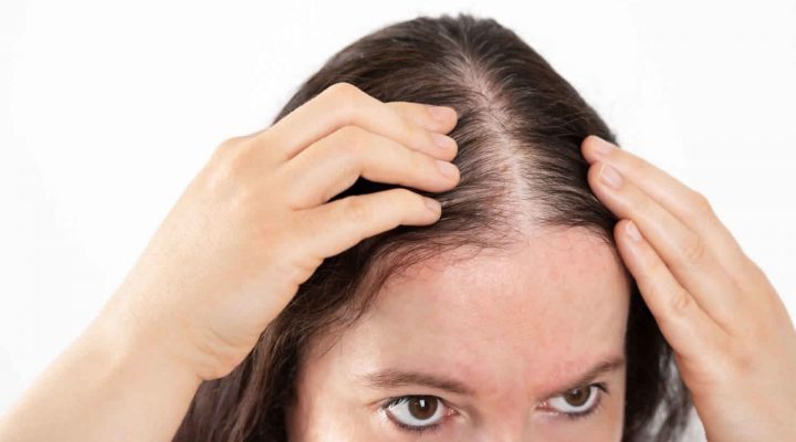 مشاكل الشعر الخفيف