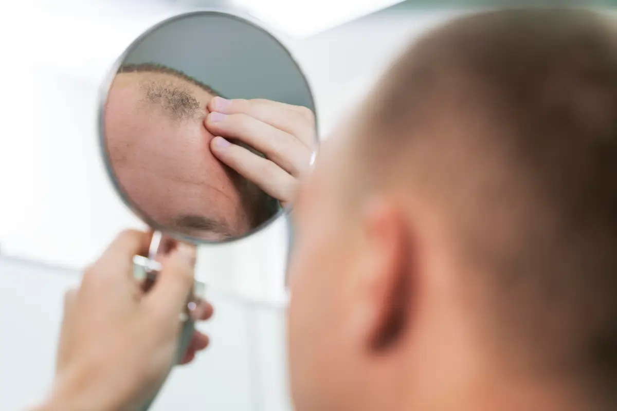 افضل دكتور زراعة شعر