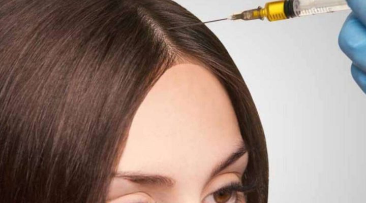 افضل علاج لتساقط الشعر وتكثيفه
