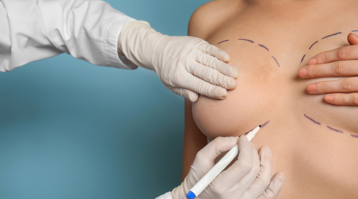 تكلفة عملية تصغير الصدر