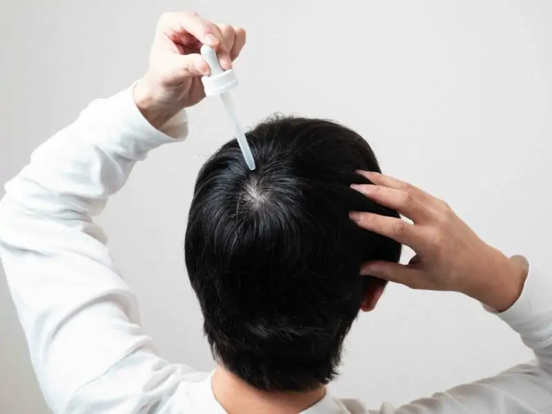 مينوكسديل Minoxidil - استخداماته 2 فوائد استخدام المينوكسيديل للشعر