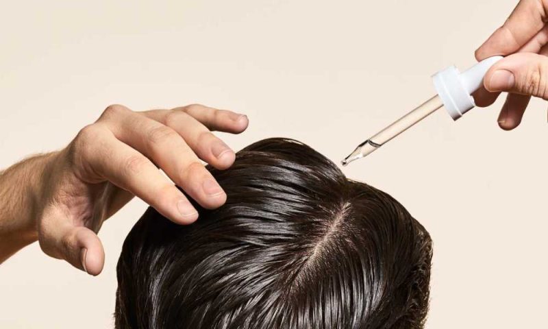 مينوكسديل Minoxidil - استخداماته 4 نصائح قبل استخدام المينوكسيديل