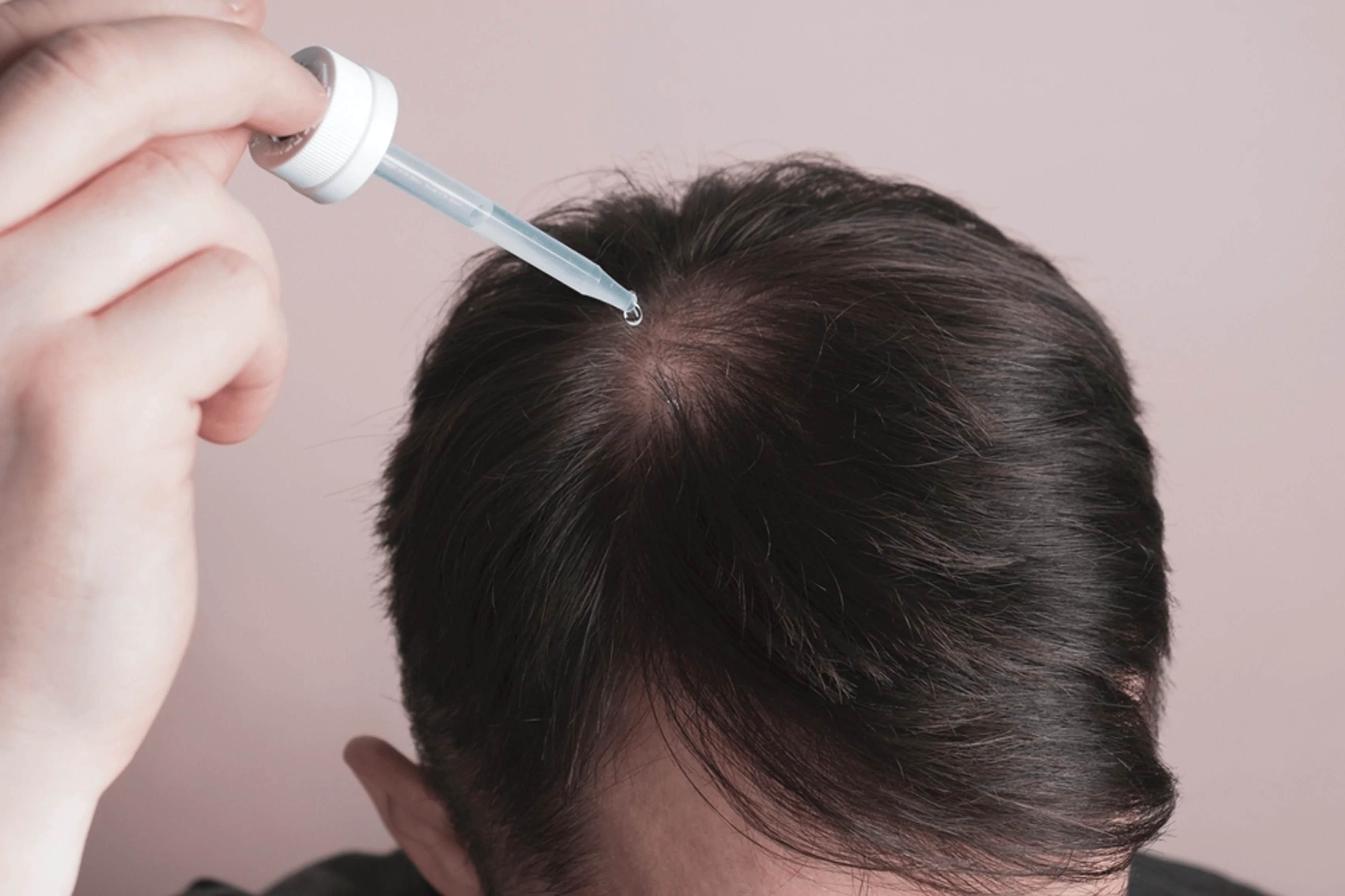 مينوكسديل Minoxidil - استخداماته 1 مينوكسديل