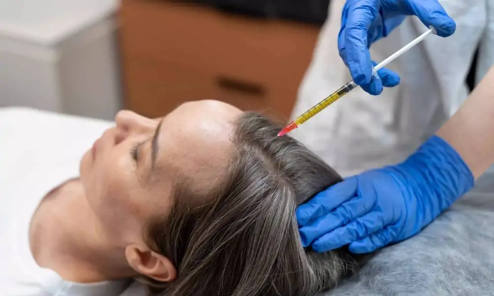 الاثار الجانبية PRP بلازما الشعر