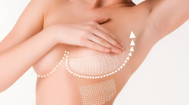 تجربتي في شد الثدي بالليزر