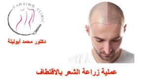 تكلفة زراعة الشعر بالاقتطاف في مصر