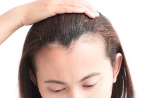 علاج الشعر التالف والمتقصف 5