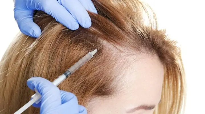 كيفية زراعة الشعر للنساء