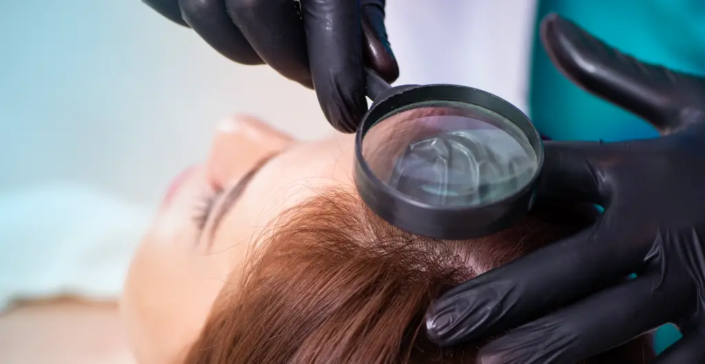 الاستعداد لعملية زراعة الشعر