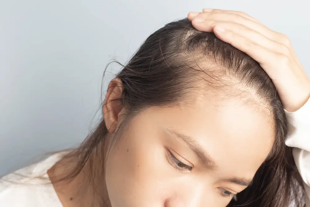 نصائح بعد زراعة شعر مقدمة الرأس للنساء