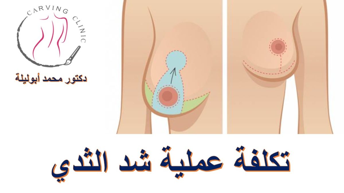 تكلفة عملية شد الثدي في مصر – أسباب ترهل الصدر