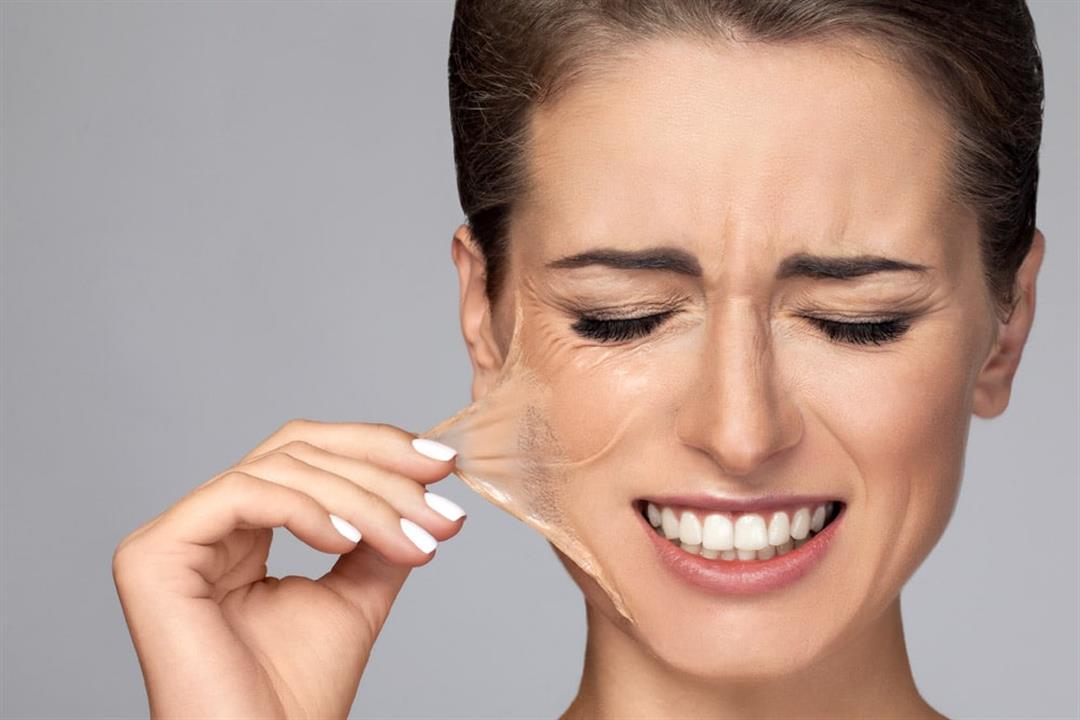 طرق علاج السواد بعد التقشير الكيميائي مضمونة 100% 6 وصفات طبيعية لعلاج اسمرار البشرة بعد التقشير