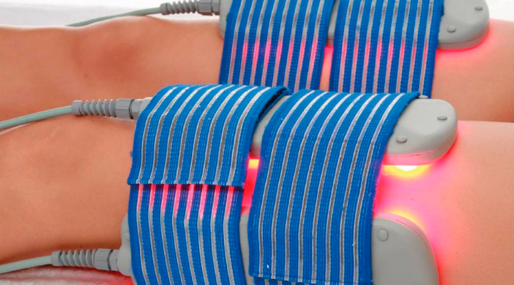 تفتيت الدهون بالليزر