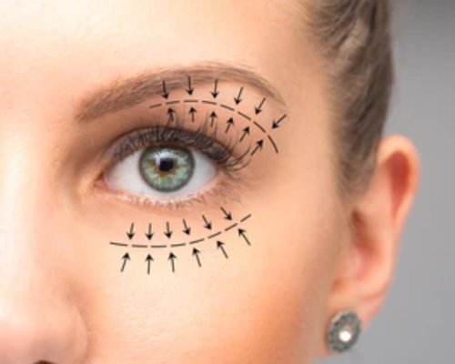 أضرار شد الجفون بالليزر