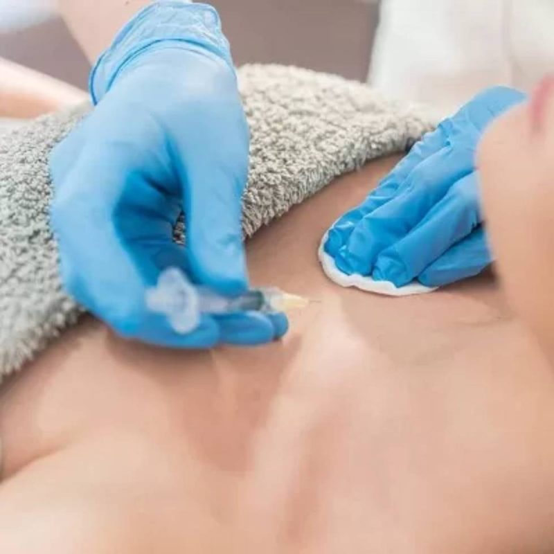 ما هي حقن البلازما لتكبير الثدي PRP Breast Injection؟