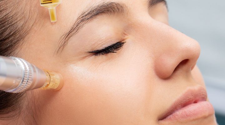 علاج الكدمات بعد حقن الفيلر