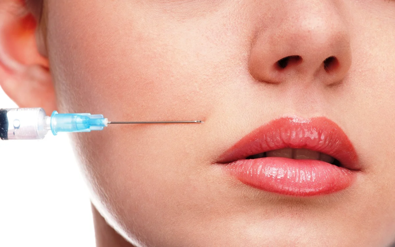 اسعار حقن الفيلر في مصر 2025 في كارفينج كلينك 3 خصائص حقن الفيلر