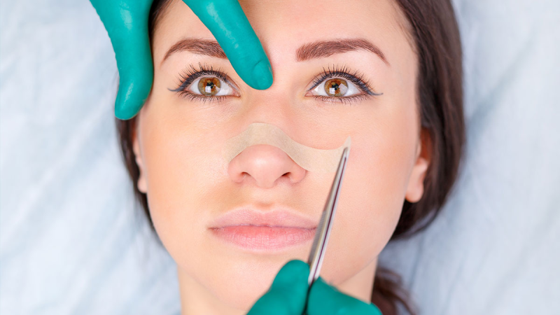 تصغير أرنبة الأنف طبيعيًا