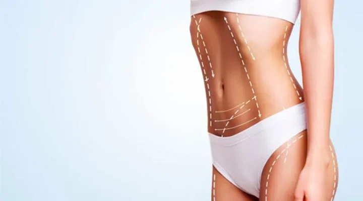 ما هو العمر المناسب لعملية شفط الدهون؟