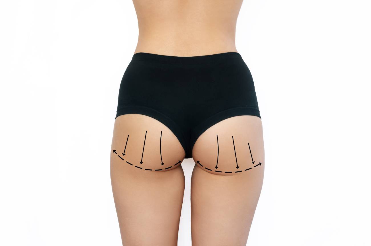 رفع الأرداف 2