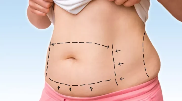 علامات فشل عملية شفط الدهون