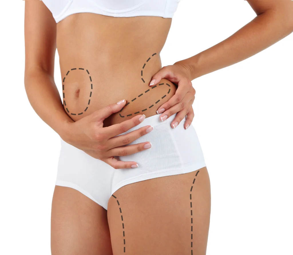 مناطق شفط الدهون في الجسم