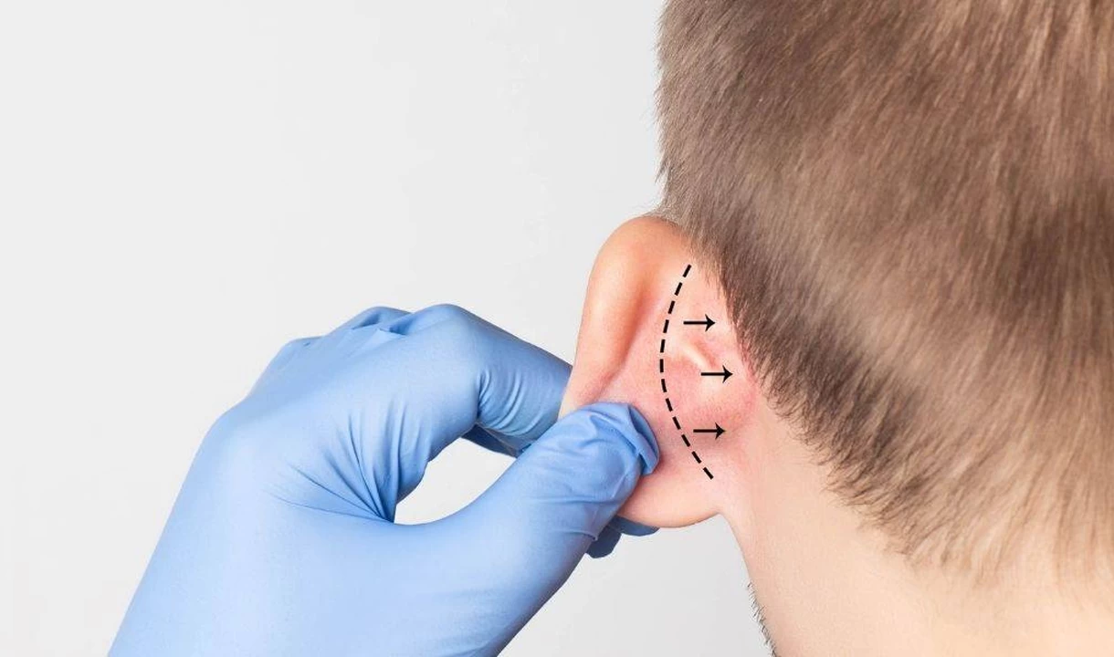 علاج الأذن الخفاشية