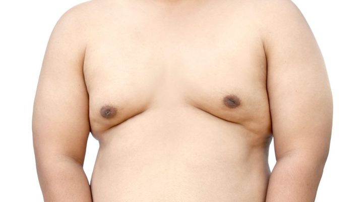 اضرار عملية التثدي عند الرجال