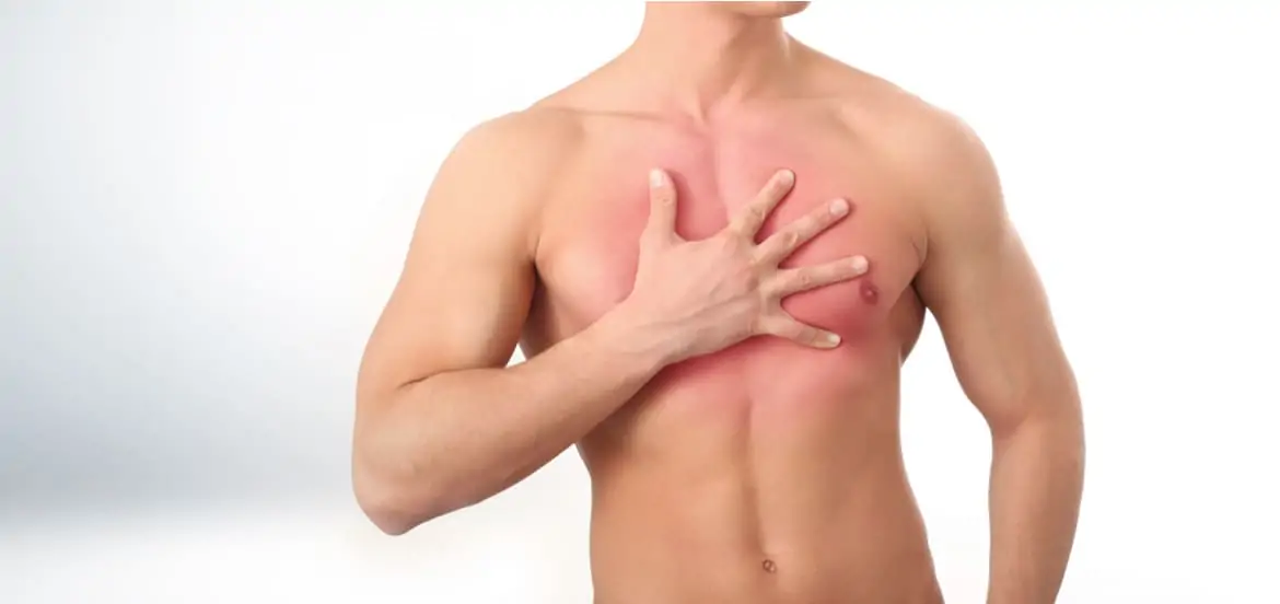 أسباب انتفاخ الثدي فجأة عند الرجل