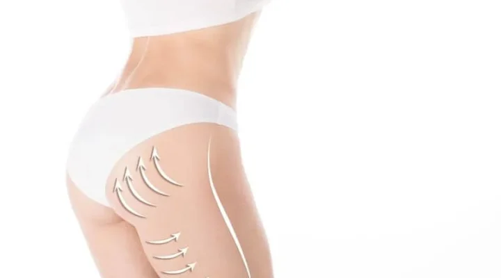 شد المؤخرة ورفعها