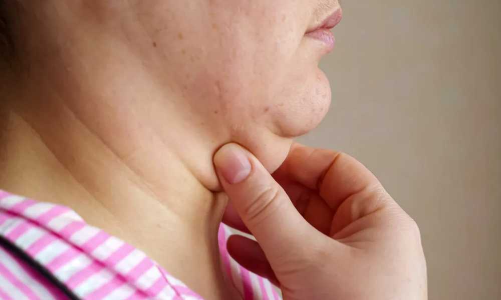 طريقة إزالة اللغلوغ بدون جراحة