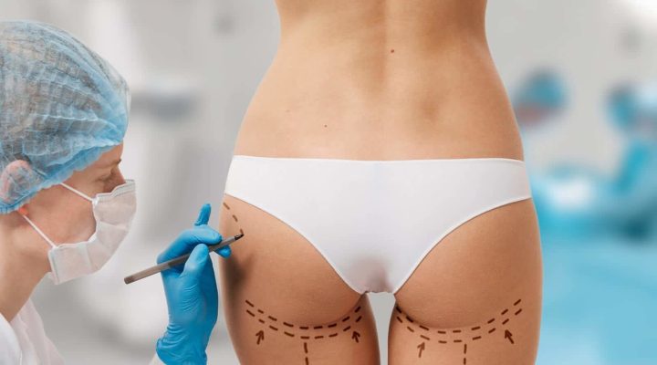 تكلفة عملية تكبير المؤخرة في مصر