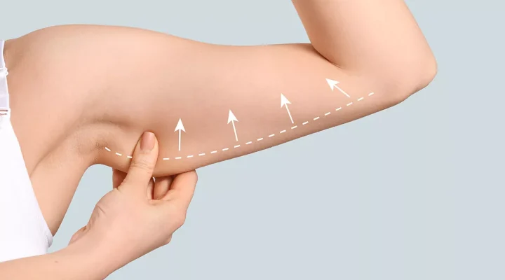 شد الذراعين بالفيزر بنتائج مضمونة 100% | د. محمد أبو ليلة 1 شد الذراعين بالفيزر