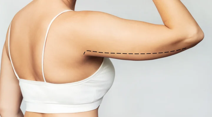 نتائج شفط الزنود بالفيزر بالصور 2 شفط الزنود بالفيزر