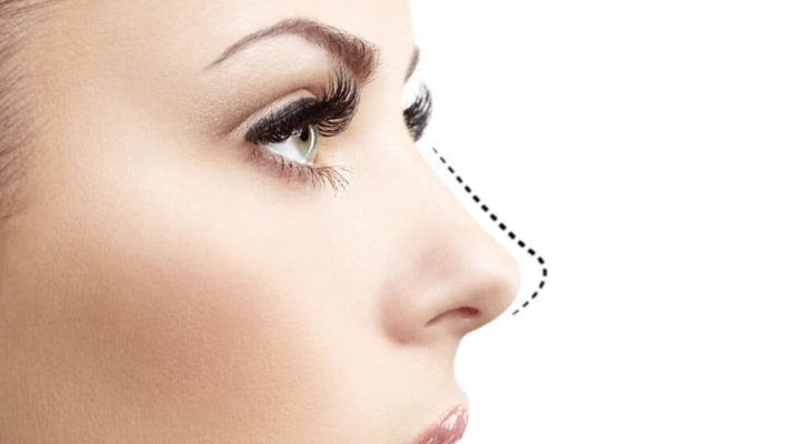 عمليات تجميل الأنف