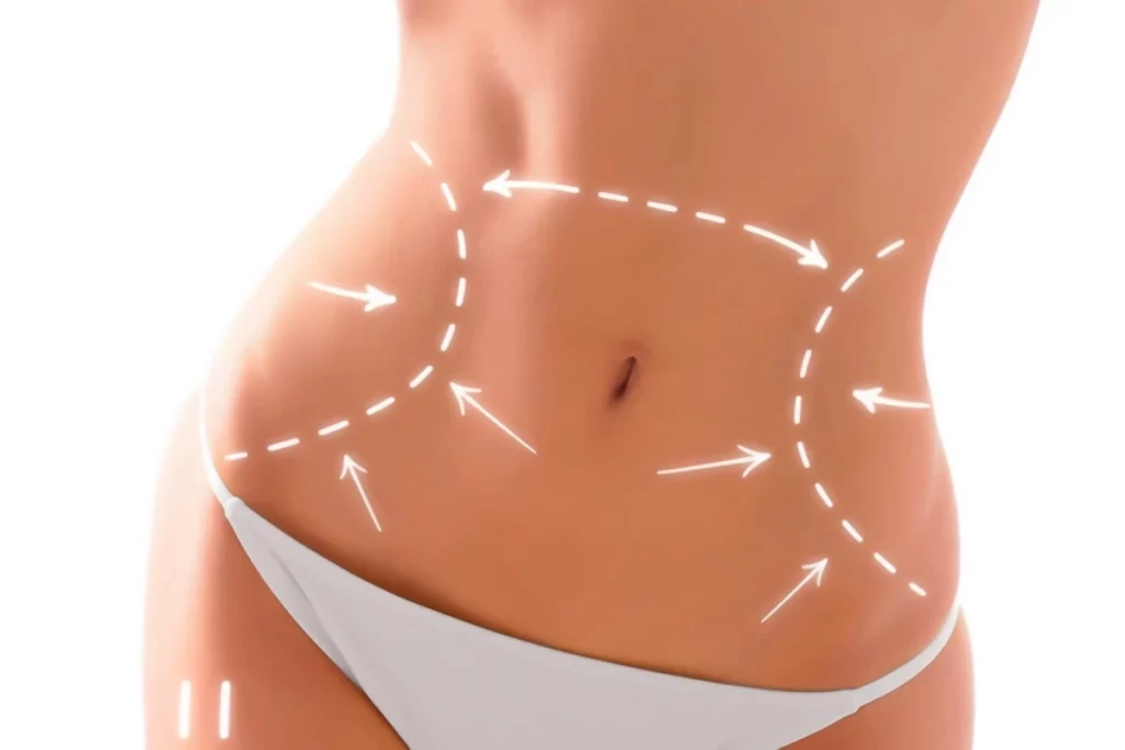 أنواع نحت الجسم