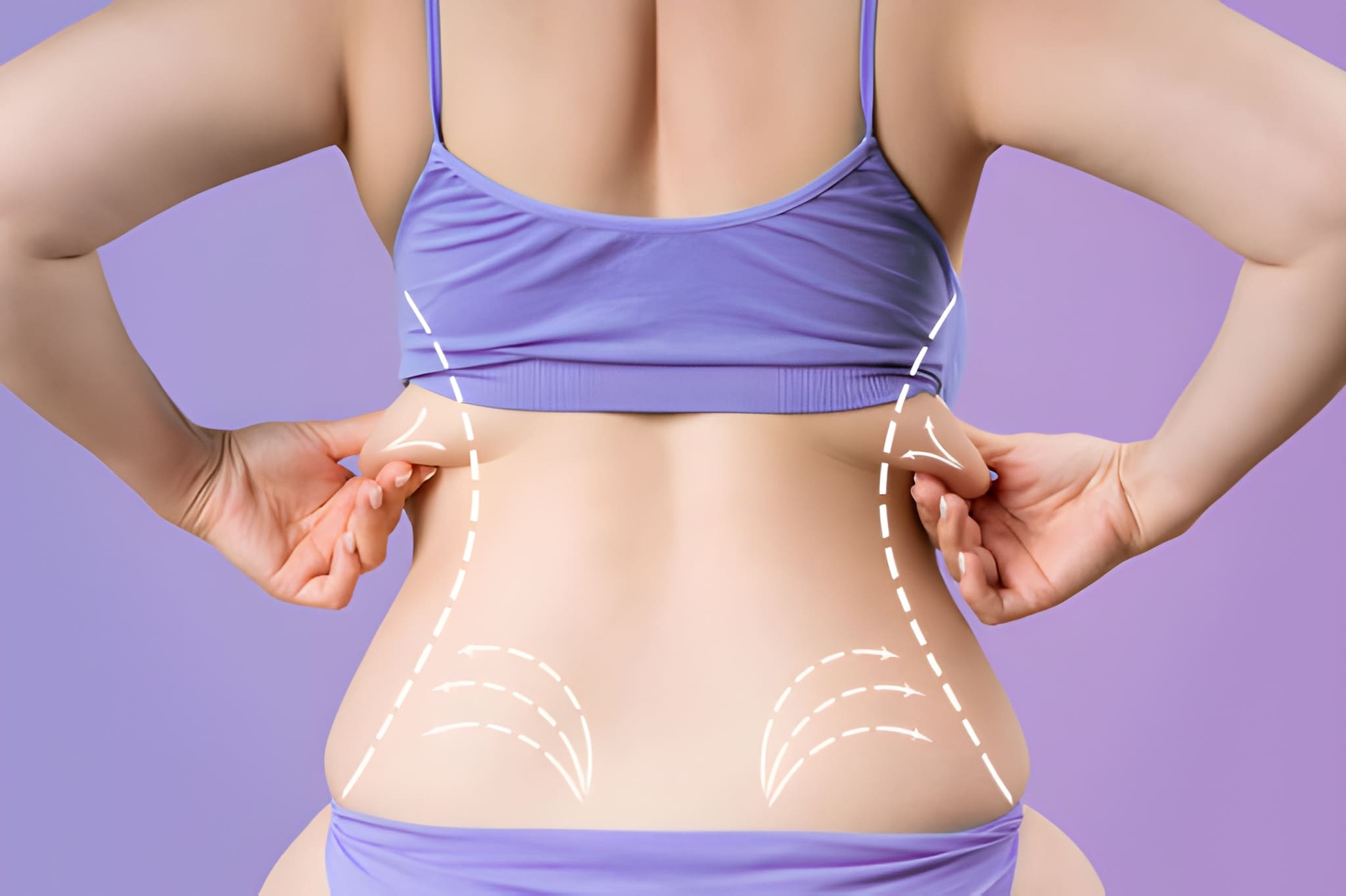 خطوات عملية شفط دهون الذراعين