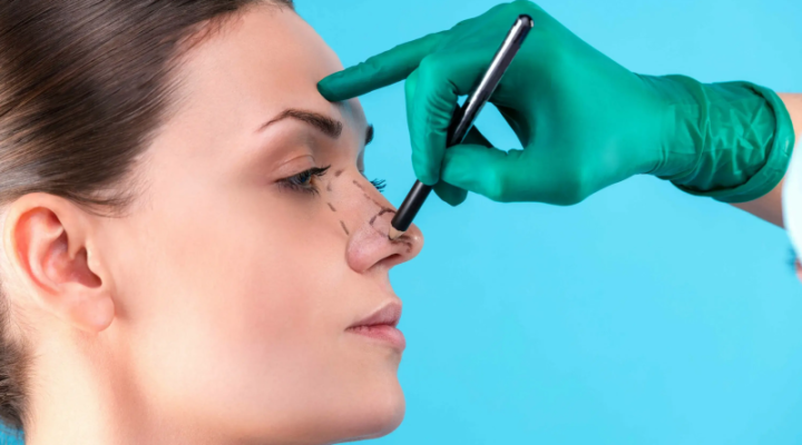 افضل دكتور تجميل انف في مصر