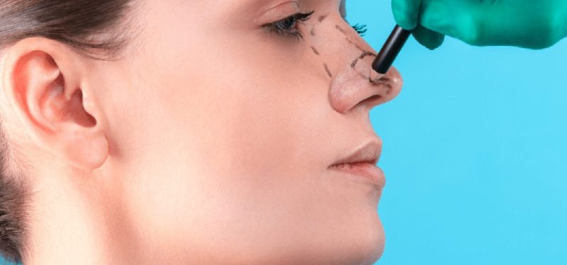 افضل دكتور تجميل انف في مصر | دكتور محمد أبوليلة 7 جراحة تجميل نهاية الأنف