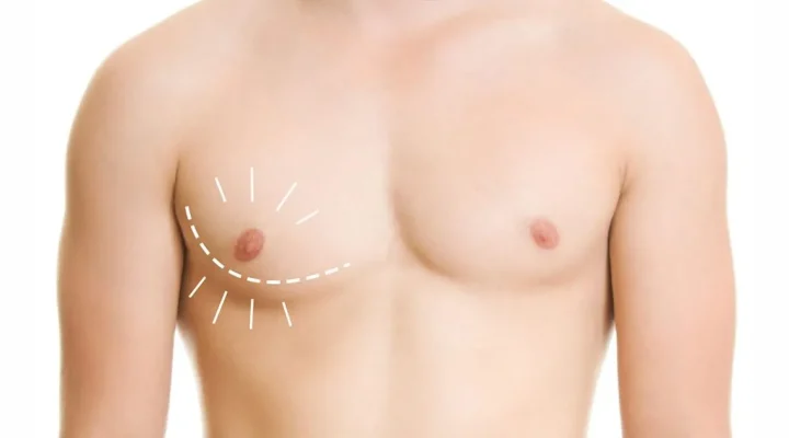 تجربتي مع عملية التثدي