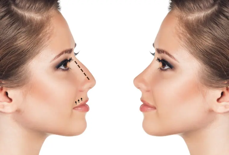 افضل دكتور تجميل انف في مصر | دكتور محمد أبوليلة 2 ما هي جراحة تجميل الانف؟