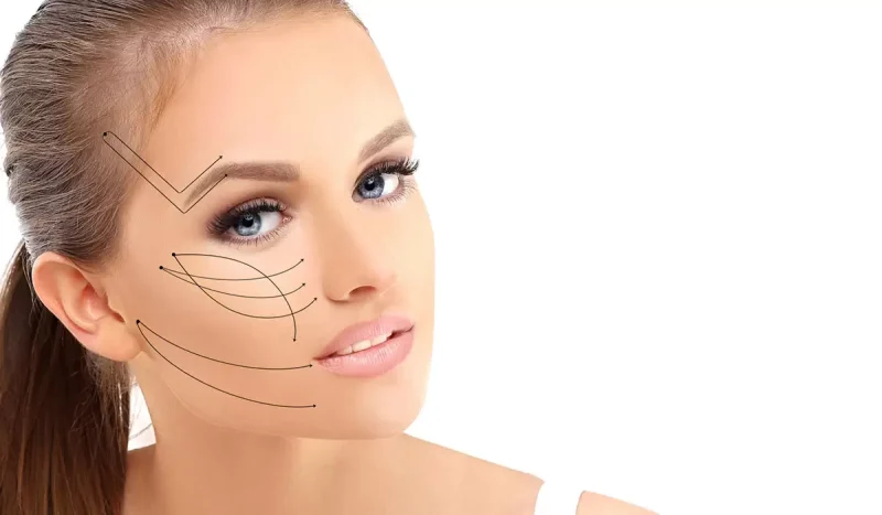نتائج عملية شد الوجه الطبيعية بدون تدخل جراحي 5 نتائج عملية شد الوجه
