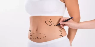 الفرق بين عملية شفط الدهون وشد البطن