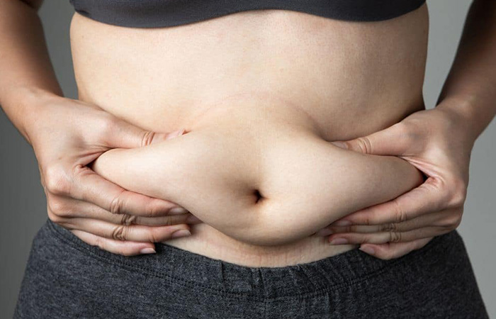 ما هي درجات ترهل البطن؟