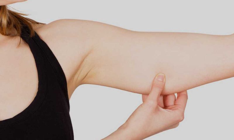 تكلفة عملية شد الذراعين في مصر عام 2026 4 ما هو شفط دهون الذراعين بالفيزر؟