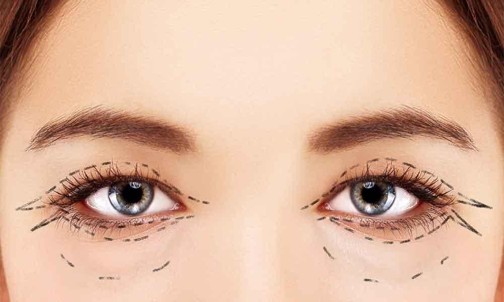 عملية قص الجفون بالليزر مع د. محمد أبوليلة 4 لماذا قد تحتاج إلى عملية قص الجفون؟