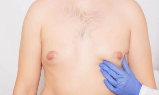 كيفية التخلص من التثدي عند الرجال في أسبوع؟